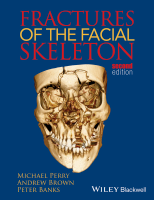 Fractures of The Facial Skeleton.pdf